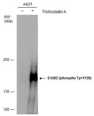 Western Blot: ErbB2/Her2 [p Tyr1139] Antibody [NBP3-12918]